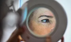 Cilt kanserinin büyümesine yol açan molekül keşfedildi