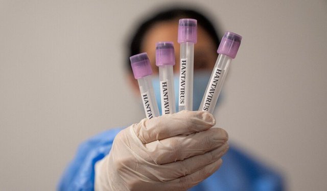 Dünya